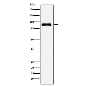 SATB2兔多抗,SATB2 Rabbit Polyclonal Antibody