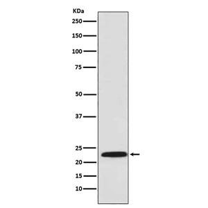 Proteasome beta 8兔多抗,Proteasome beta 8 Rabbit Polyclonal Antibody