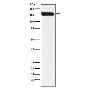 KAT13A兔多抗,KAT13A Rabbit Polyclonal Antibody