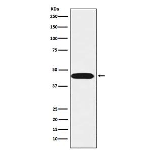 LIS1兔多抗,LIS1 Rabbit Polyclonal Antibody