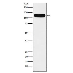DDB1兔多抗,DDB1 Rabbit Polyclonal Antibody