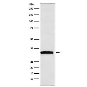 GDF15兔多抗,GDF15 Rabbit Polyclonal Antibody
