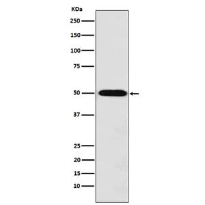 Monocarboxylic Acid Transporter 1兔多抗,Monocarboxylic Acid Transporter 1 Rabbit Polyclonal Antibody