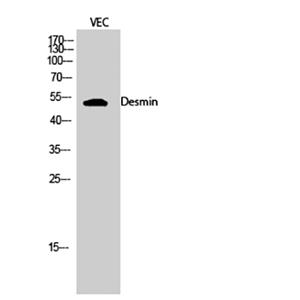 Desmin兔多抗,Desmin Rabbit Polyclonal Antibody