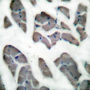 Desmin兔多抗,Desmin Rabbit Polyclonal Antibody