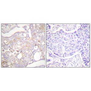 Claudin 4兔多抗,Claudin 4 Rabbit Polyclonal Antibody