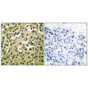 MCL1兔多抗,MCL1 Rabbit Polyclonal Antibody