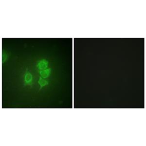 MSK1兔多抗,MSK1 Rabbit Polyclonal Antibody