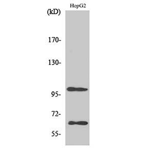 SIRP alpha兔多抗,SIRP alpha Rabbit Polyclonal Antibody