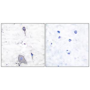 SIRP alpha兔多抗,SIRP alpha Rabbit Polyclonal Antibody