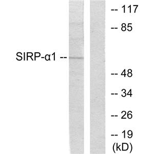 SIRP alpha兔多抗,SIRP alpha Rabbit Polyclonal Antibody