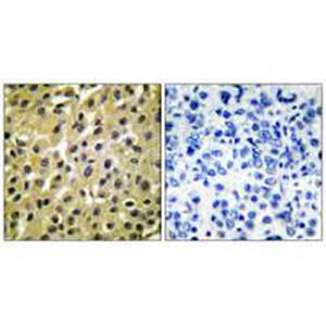 MDM2兔多抗,MDM2 Rabbit Polyclonal Antibody