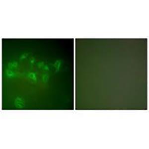 MDM2兔多抗,MDM2 Rabbit Polyclonal Antibody