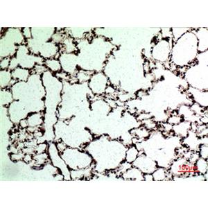 CD62L兔多抗,CD62L Rabbit Polyclonal Antibody