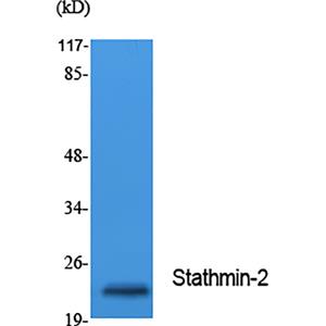Stathmin 2兔多抗,Stathmin 2 Rabbit Polyclonal Antibody