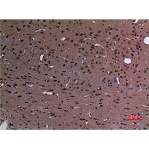Stathmin 2兔多抗,Stathmin 2 Rabbit Polyclonal Antibody