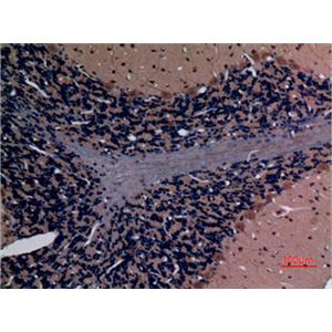 Stathmin 2兔多抗,Stathmin 2 Rabbit Polyclonal Antibody