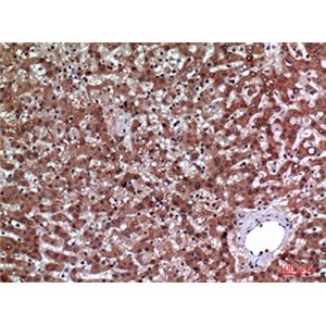 IGFBP3兔多抗,IGFBP3 Rabbit Polyclonal Antibody