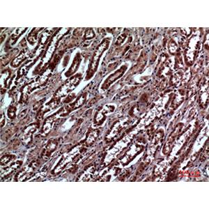 IGFBP3兔多抗,IGFBP3 Rabbit Polyclonal Antibody