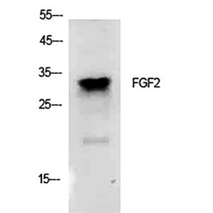 FGF2兔多抗,FGF2 Rabbit Polyclonal Antibody