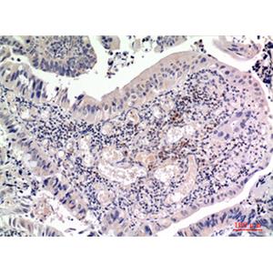 FGF2兔多抗,FGF2 Rabbit Polyclonal Antibody