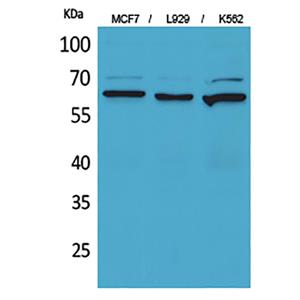 CD73兔多抗,CD73 Rabbit Polyclonal Antibody
