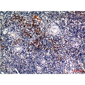Syndecan 1兔多抗,Syndecan 1 Rabbit Polyclonal Antibody