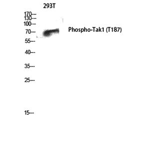 Phospho-TAK1 (Thr187) Rabbit Polyclonal Antibody | 兔多抗 | EnkiLife恩玑生命