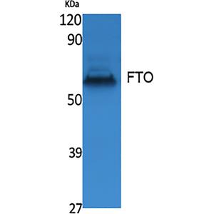 FTO兔多抗,FTO Rabbit Polyclonal Antibody