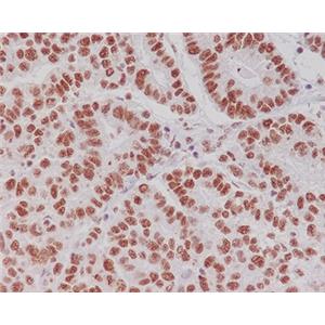 Phospho-CREB (Ser133)兔多抗,Phospho-CREB (Ser133) Rabbit Polyclonal Antibody