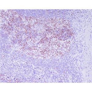 Phospho-Histone H3 (Thr3)兔多抗,Phospho-Histone H3 (Thr3) Rabbit Polyclonal Antibody