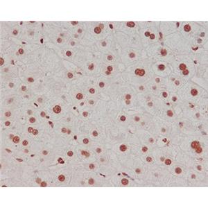 DiMethyl-Histone H3 (Lys4)兔多抗,DiMethyl-Histone H3 (Lys4) Rabbit Polyclonal Antibody