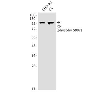Phospho-Rb (Ser807)兔多抗,Phospho-Rb (Ser807) Rabbit Polyclonal Antibody