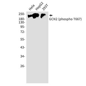 Phospho-GCN2 (Thr667)兔多抗,Phospho-GCN2 (Thr667) Rabbit Polyclonal Antibody