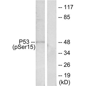 Phospho-p53 (Ser15)兔多抗,Phospho-p53 (Ser15) Rabbit Polyclonal Antibody