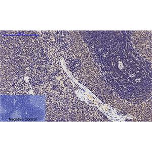Phospho-p53 (Ser15)兔多抗,Phospho-p53 (Ser15) Rabbit Polyclonal Antibody