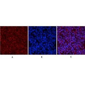 Phospho-p53 (Ser15)兔多抗,Phospho-p53 (Ser15) Rabbit Polyclonal Antibody