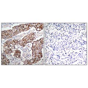 Phospho-EGFR (Tyr1092)兔多抗,Phospho-EGFR (Tyr1092) Rabbit Polyclonal Antibody