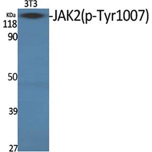 Phospho-JAK2 (Tyr1007)兔多抗,Phospho-JAK2 (Tyr1007) Rabbit Polyclonal Antibody