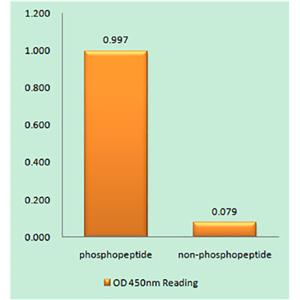 Phospho-BRCA1 (Ser1423)兔多抗,Phospho-BRCA1 (Ser1423) Rabbit Polyclonal Antibody