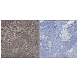 Phospho-CREB (Ser142)兔多抗,Phospho-CREB (Ser142) Rabbit Polyclonal Antibody