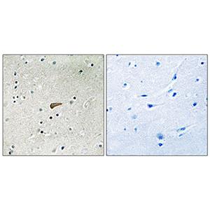 Phospho-FRS2 (Tyr436)兔多抗,Phospho-FRS2 (Tyr436) Rabbit Polyclonal Antibody