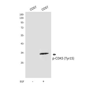 Phospho-CDK5 (Tyr15)兔多抗,Phospho-CDK5 (Tyr15) Rabbit Polyclonal Antibody