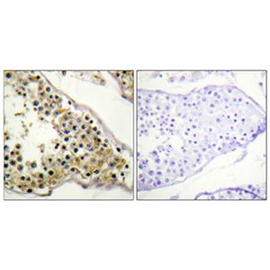 Phospho-ITK (Tyr512)兔多抗,Phospho-ITK (Tyr512) Rabbit Polyclonal Antibody