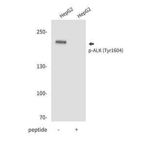 Phospho-ALK (Tyr1604)兔多抗,Phospho-ALK (Tyr1604) Rabbit Polyclonal Antibody