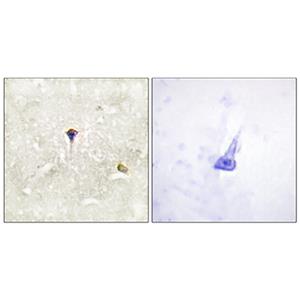 Phospho-ALK (Tyr1604)兔多抗,Phospho-ALK (Tyr1604) Rabbit Polyclonal Antibody