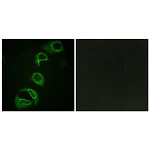 Phospho-ALK (Tyr1604)兔多抗,Phospho-ALK (Tyr1604) Rabbit Polyclonal Antibody