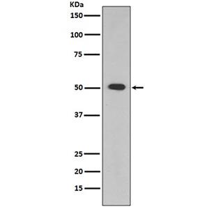 ALDH1A1兔多抗,ALDH1A1 Rabbit Polyclonal Antibody