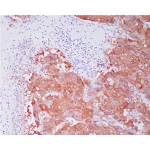 ALDH1A1兔多抗,ALDH1A1 Rabbit Polyclonal Antibody