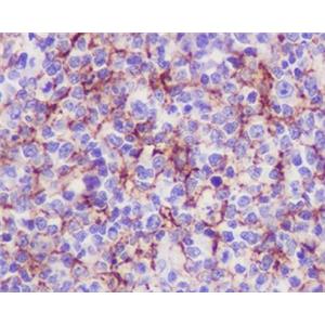 VCAM1兔多抗,VCAM1 Rabbit Polyclonal Antibody
